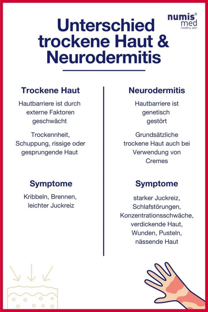 Infografik Unterschied trockene Haut und Neurodermitis