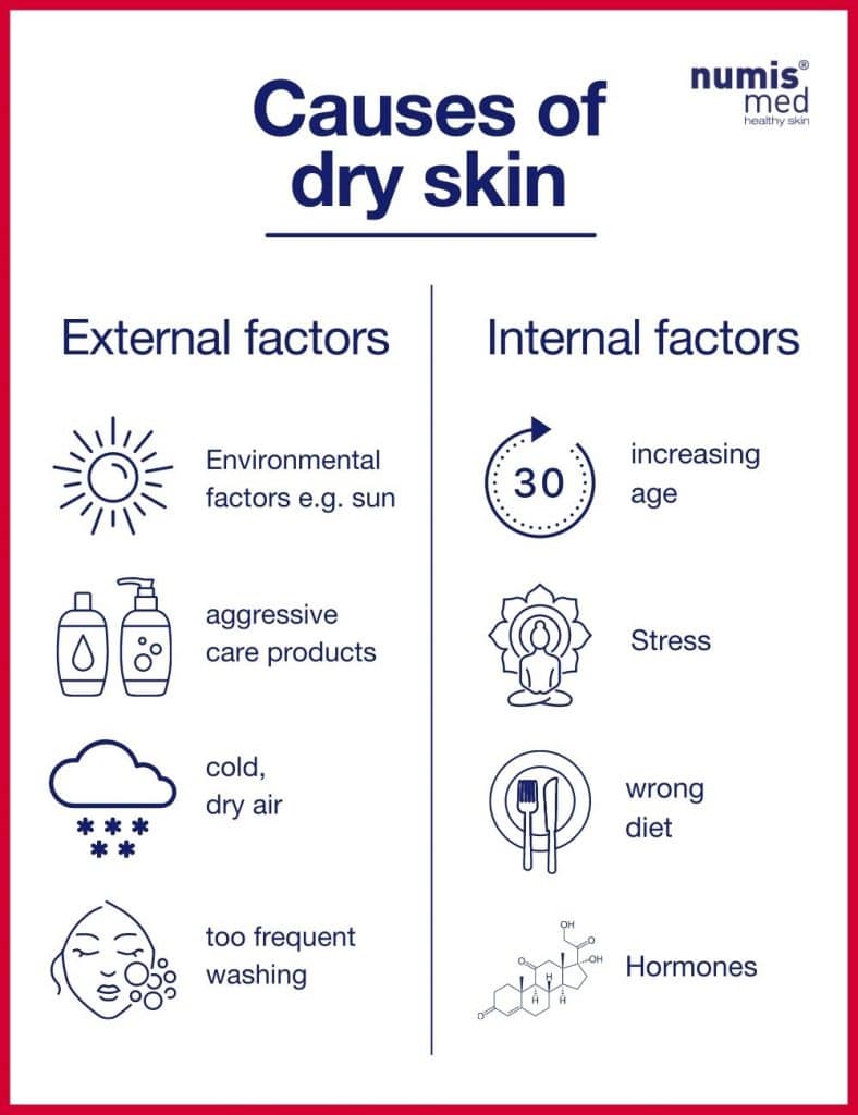 causes of dry skin infographic